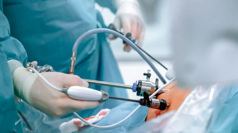 Bariatric surgery changed one woman's life — and it could help millions more