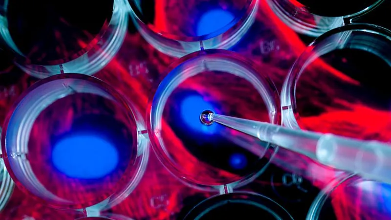 Low-dose ruxolitinib slashes GVHD risk after stem cell transplant