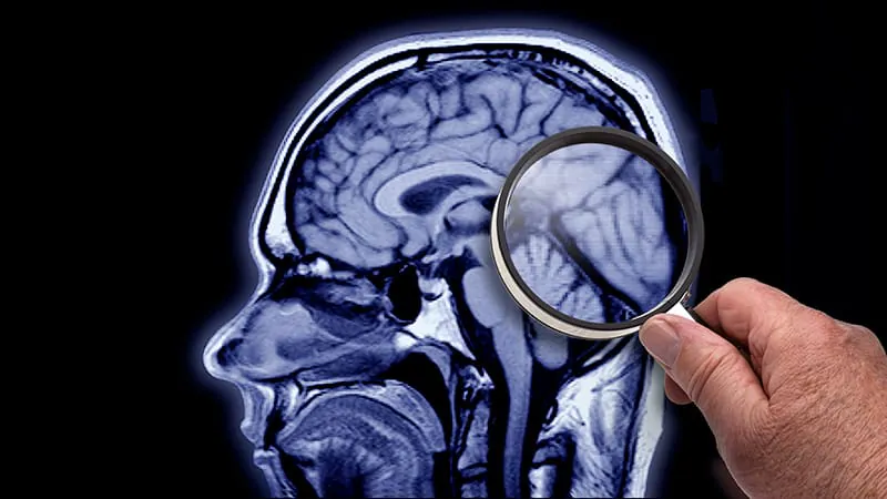 Do Alzheimer's drugs really work long-term? New analysis raises doubts