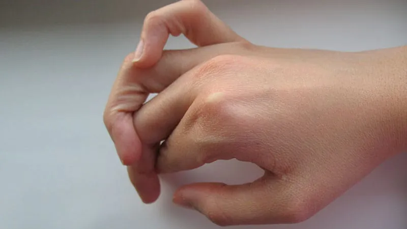 Being double-jointed may dramatically raise your anxiety risk — and most doctors don't know it