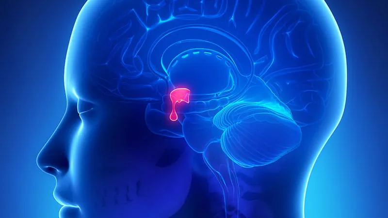 Brain fog and fatigue linger in women with prolactinoma — even after treatment