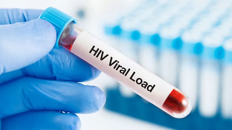 Fostemsavir keeps hard-to-treat HIV patients suppressed in real-world study