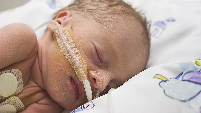 Ultrasound diaphragm measurements may predict ventilator weaning success in infants
