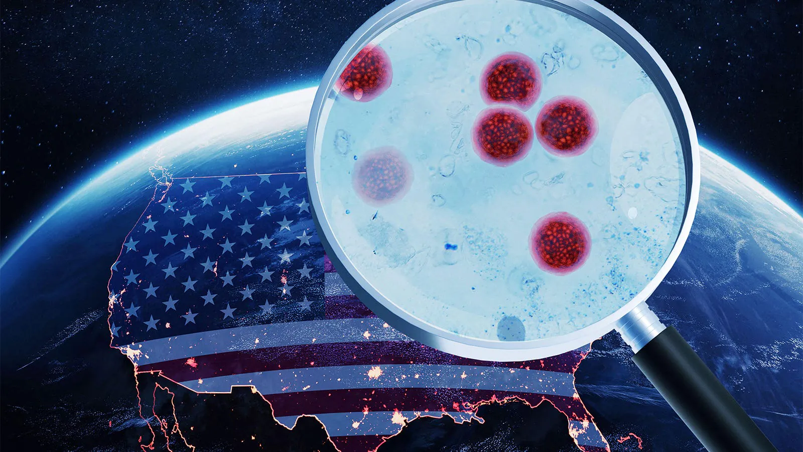 America's Cyclospora crisis is bigger than the headlines — and federal cuts are making it harder to track