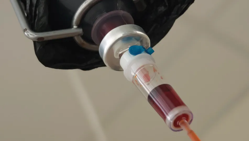 Pre-surgery IV iron boosts recovery and cuts transfusions in cardiac patients