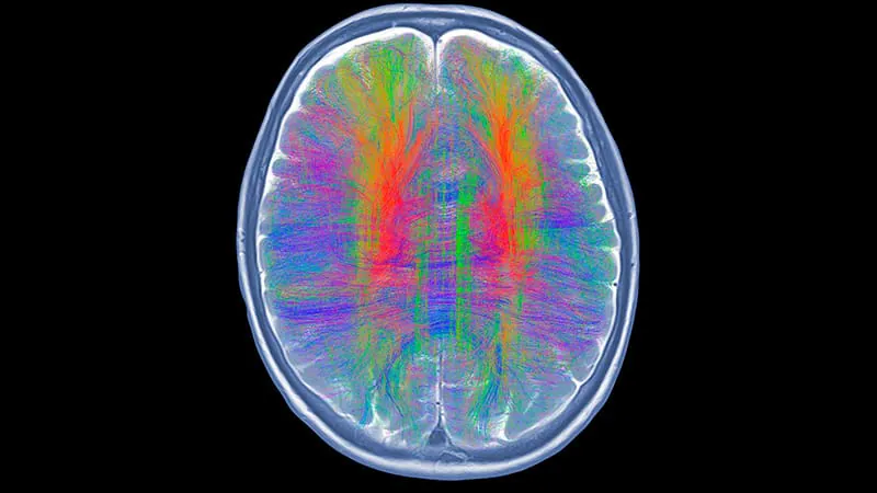 Silent brain changes on MRI may signal serious mortality risk — even before cognitive decline begins