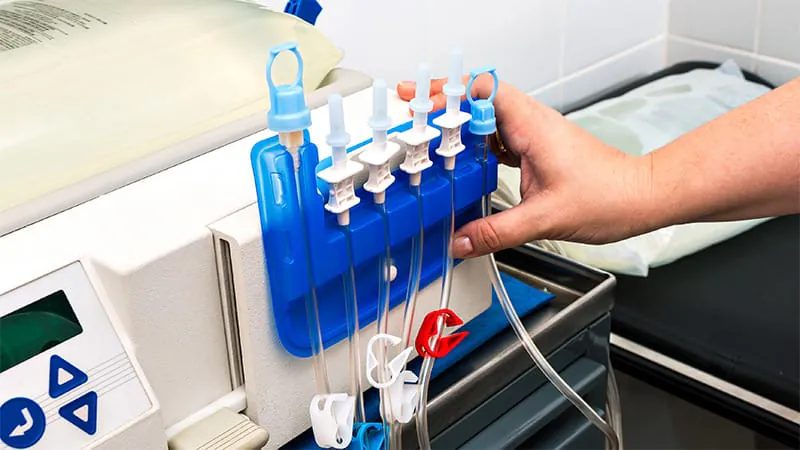 Sleep apnea triples atrial fibrillation risk in peritoneal dialysis patients