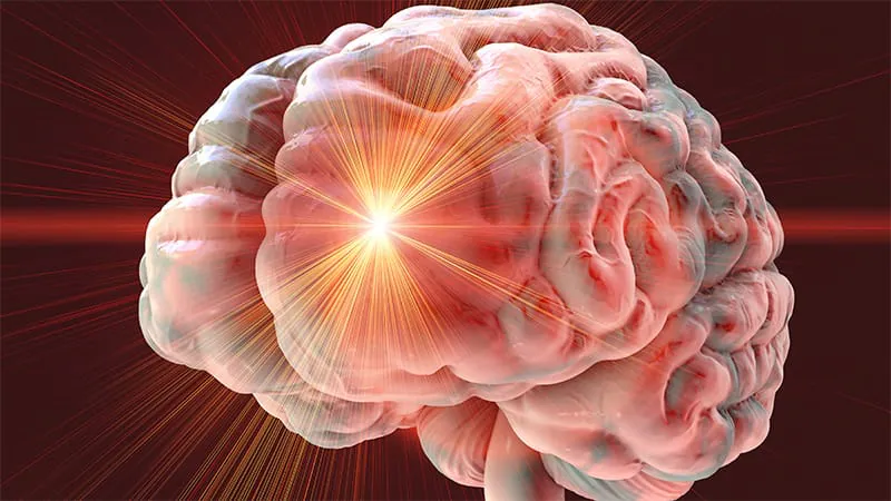 Not all exercise is equal for stroke recovery — here's what works best