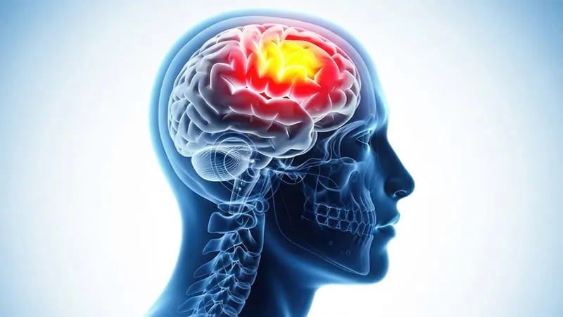 Mild traumatic brain injury isn't so mild: 1 in 7 patients dies within a year