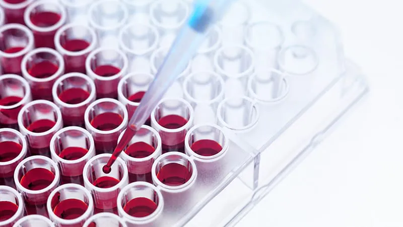New HIV drug resistance assay delivers results in 2 hours for just $4