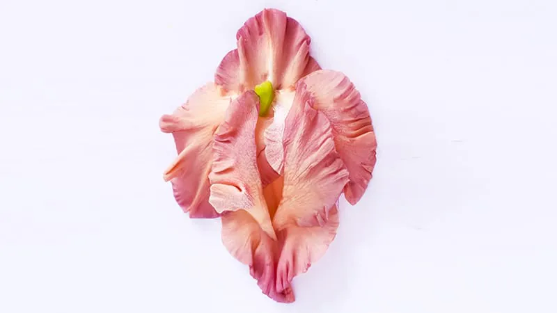 Vulvar lichen sclerosus affects nearly 200,000 US women, with older White women hit hardest