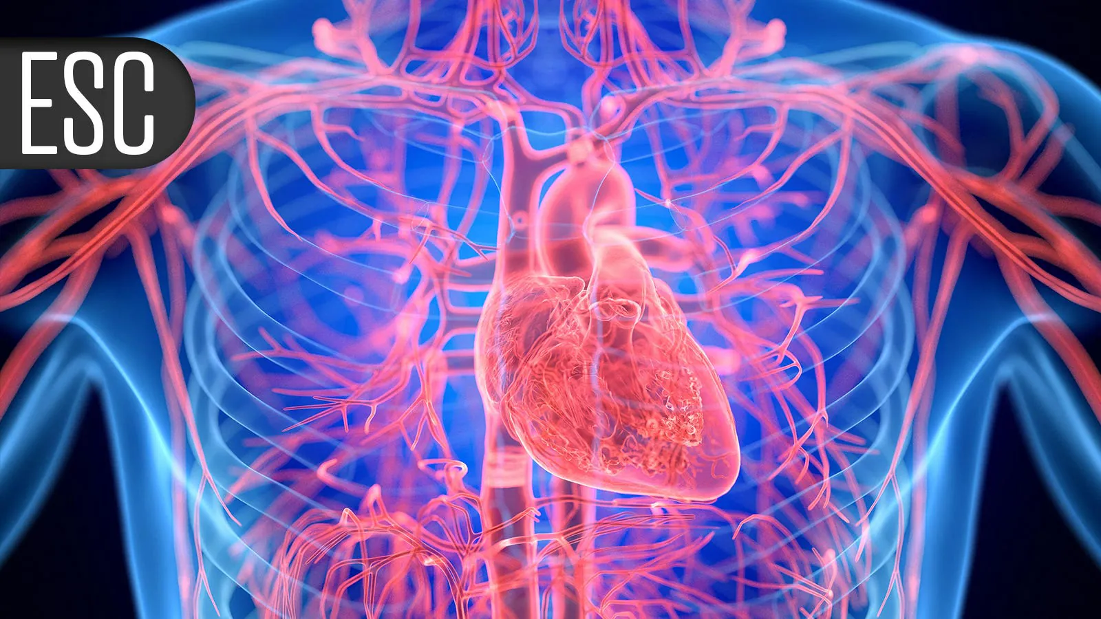 Starting PCSK9 inhibitors in the cath lab slashes LDL — but doesn't move the needle on outcomes