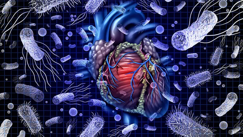 New multi-society position paper calls for hospital-wide systems overhaul to tackle sepsis