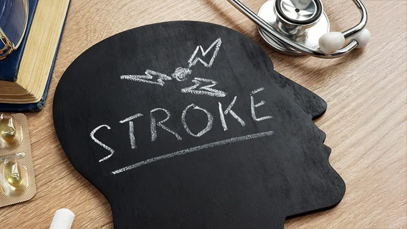 A hidden stroke trigger in young adults: What clinicians need to know