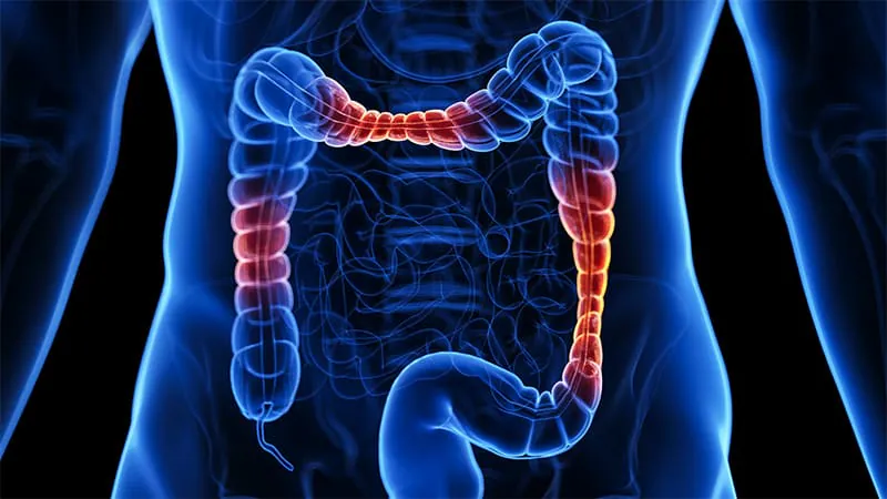 Blood DNA changes can predict ulcerative colitis years before symptoms appear