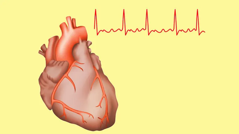 Hidden genetic mutations linked to silent brain damage and cognitive decline in AFib patients