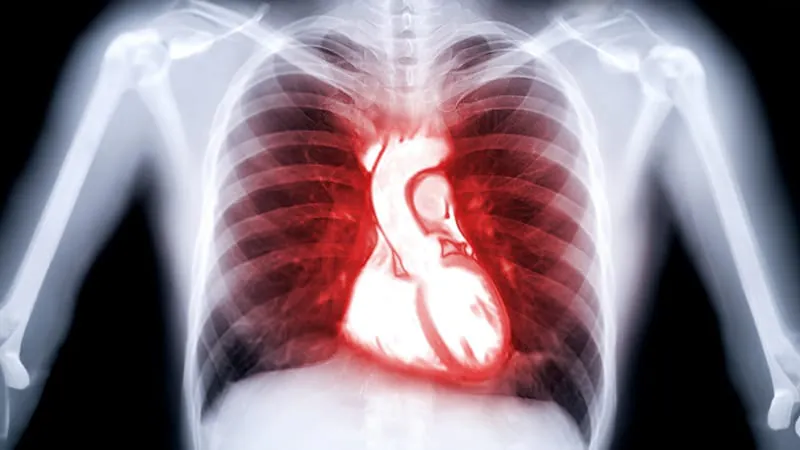 Rethinking mild pulmonary hypertension: artery stiffness beats traditional metrics for predicting death risk