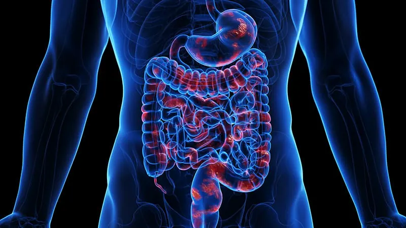 Switching to ustekinumab biosimilars in Crohn's disease is just as effective as sticking with the original