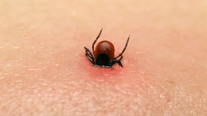 Tick-borne encephalitis leaves lasting cognitive scars, study finds