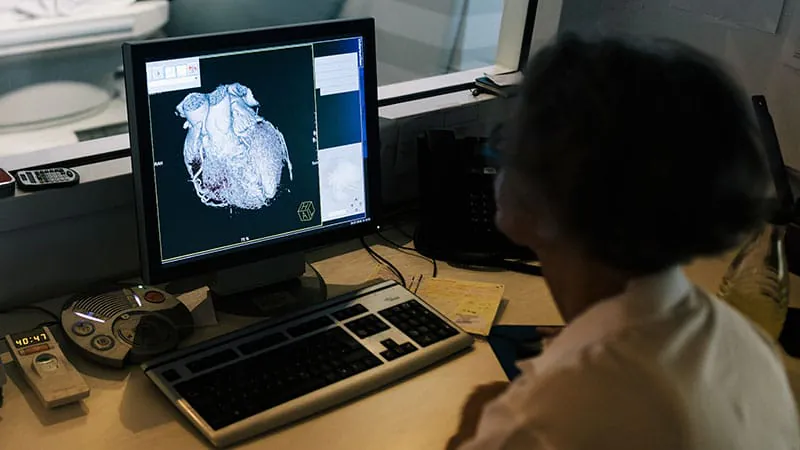 Cardiac MRI findings could flag sudden cardiac death risk in a tricky heart failure subgroup