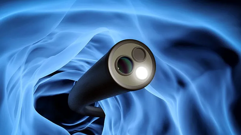 Endoscopic stricturotomy works just as well in diverted pouches — even with more severe disease