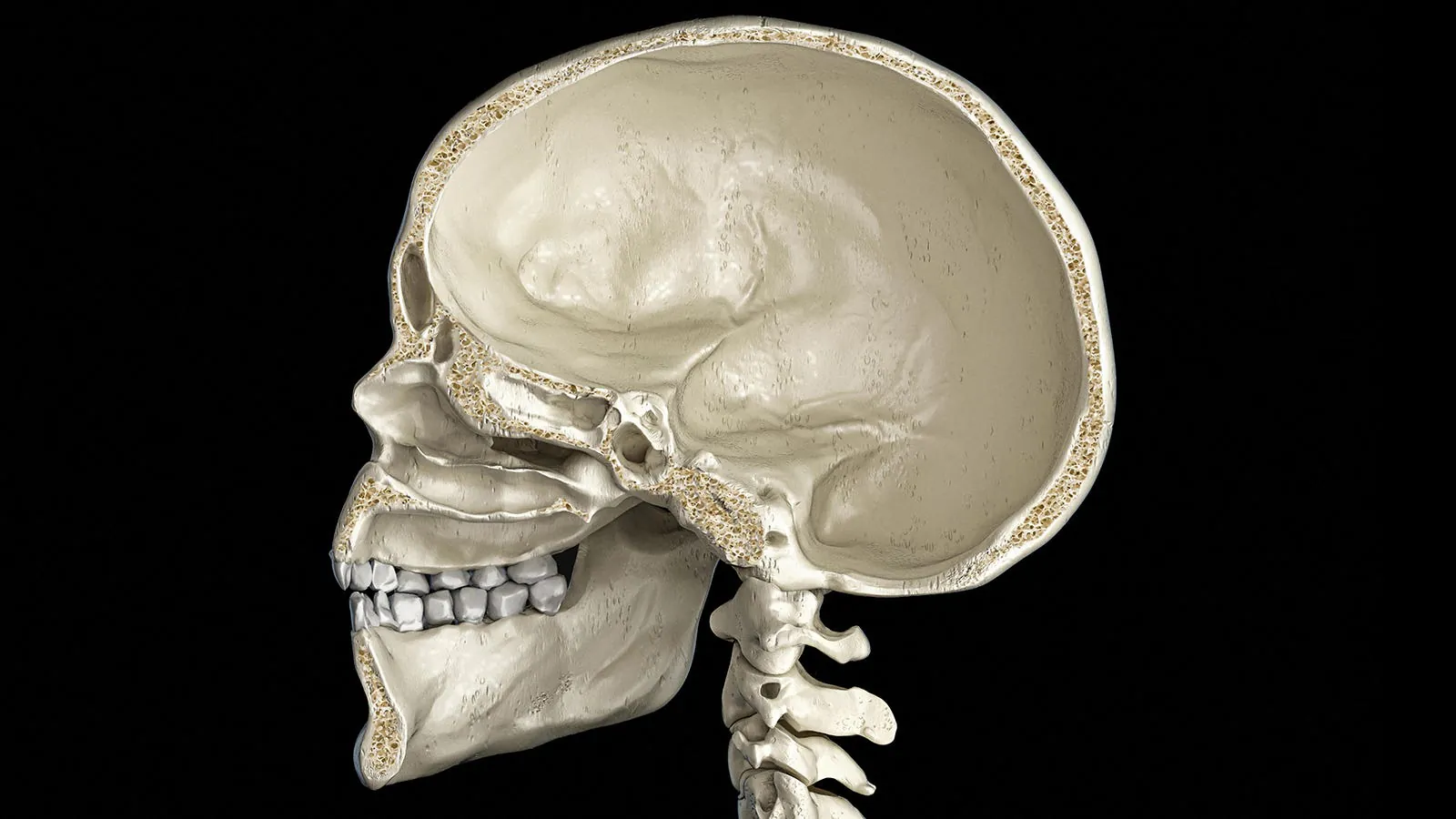 Skull bone marrow immune activity linked to chronic pain intensity