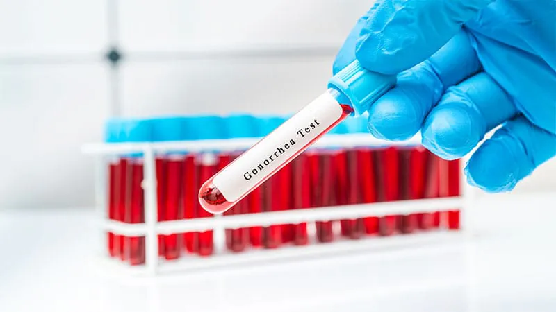 A pill for gonorrhea? New trial says yes
