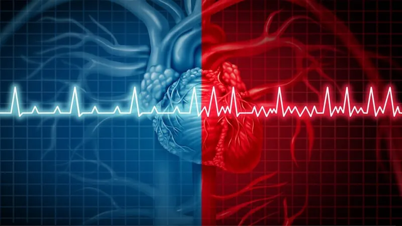 New ECG biomarker could flag post-stroke AFib risk before it strikes