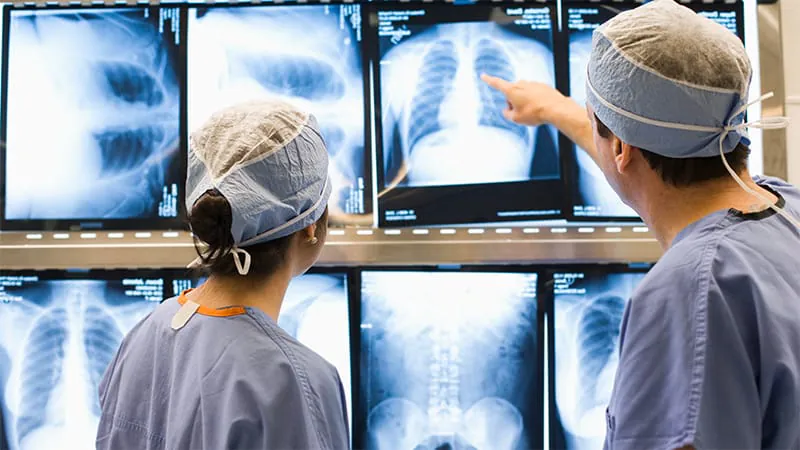 AI chest X-ray tools are faster — but are they making radiologists less accurate?