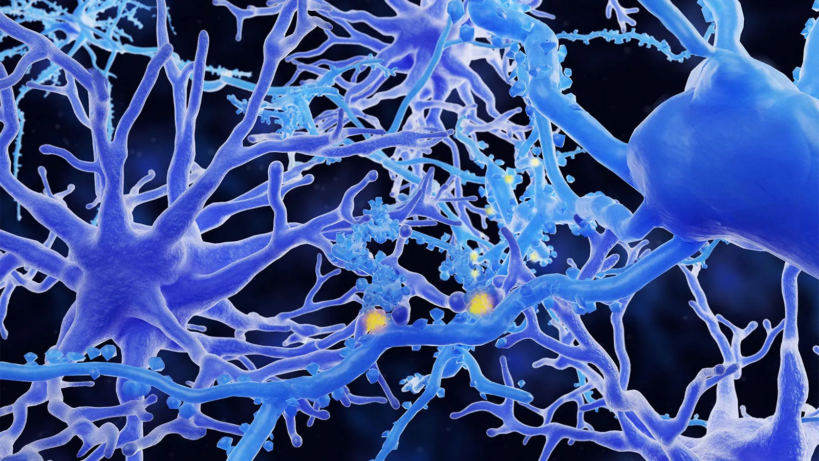 Alexander disease gets its first-ever FDA-approved treatment