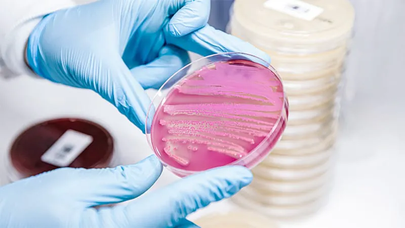 Shorter antibiotic courses may be safe for infective endocarditis — with one catch