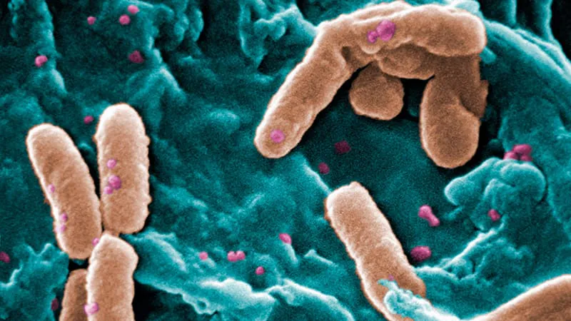 Skin complications are surprisingly common in blood cancer patients with Pseudomonas infections