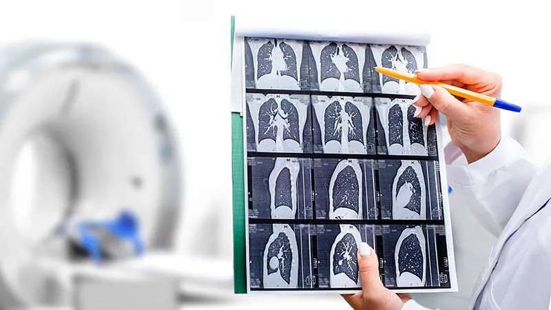 Treating the whole person: why holistic care must become the norm in chronic lung disease