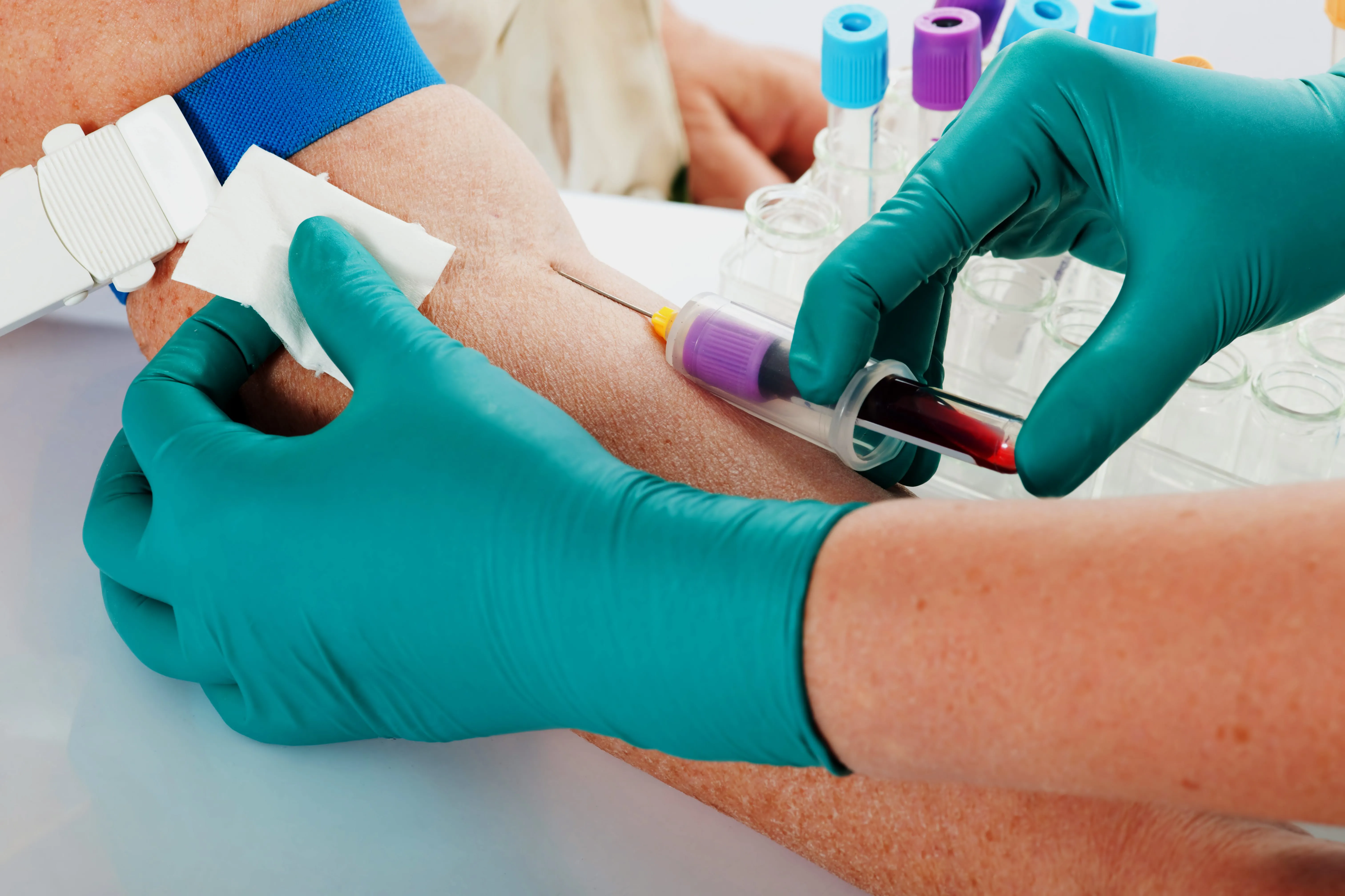 Time to ditch the daily blood draw? Experts say routine inpatient lab testing needs a rethink