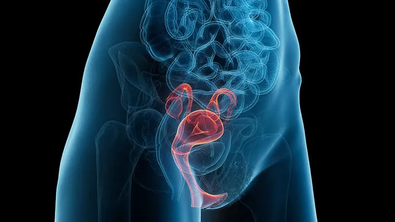 Vaginal oestrogen before prolapse surgery boosts recovery outcomes for postmenopausal women