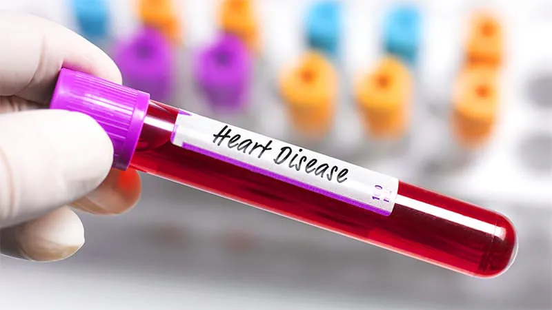 Persistently high troponin-T levels in suspected ACS patients signal elevated heart failure risk