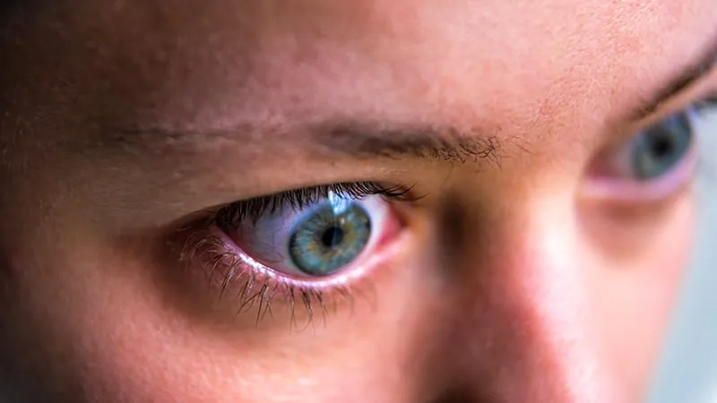 New ultrasound-based risk score could flag Graves' eye disease before it starts