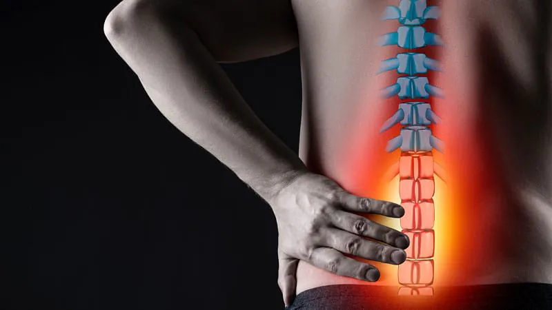 Lumbar braces for chronic back pain: more hype than help?