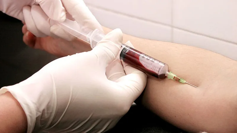 Robots are now drawing blood — and the FDA is on board