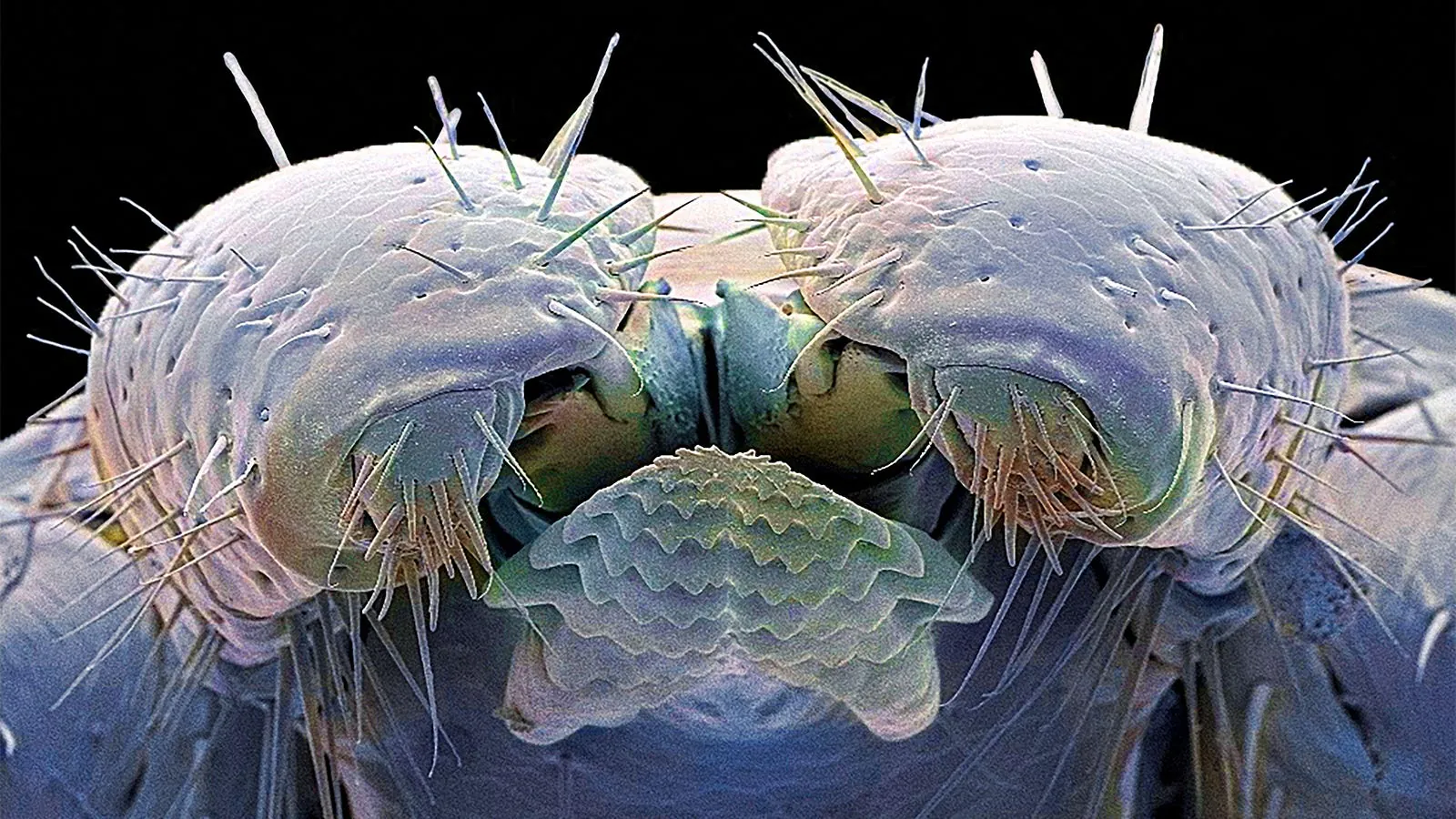 Tick-borne diseases are a growing epidemic — here's what it'll take to fight back