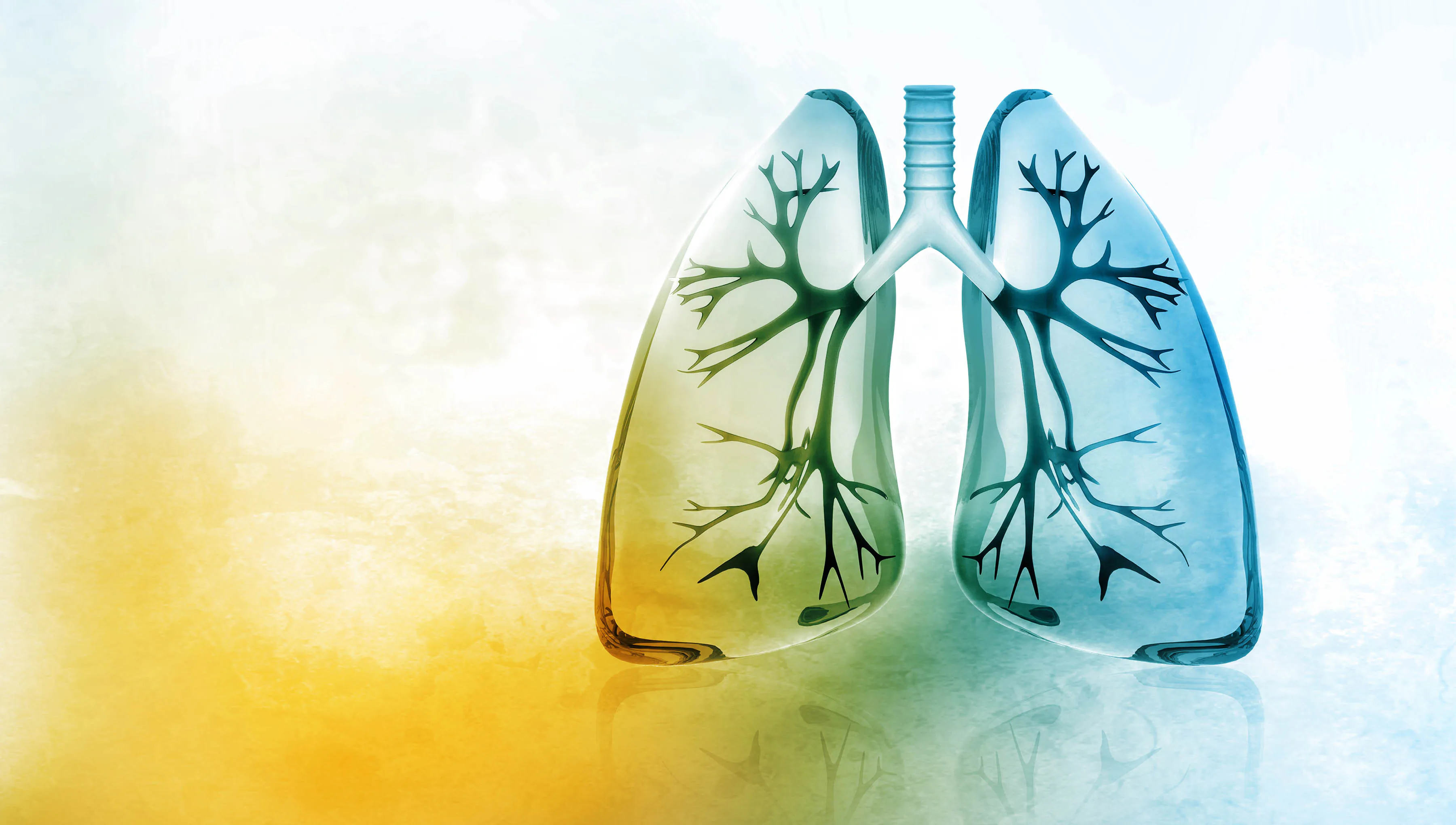 Catheter-directed thrombolysis cuts PE complications by 90% — and any cath lab can do it