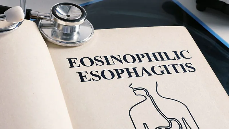 Dupilumab outperforms other biologics in achieving asthma remission