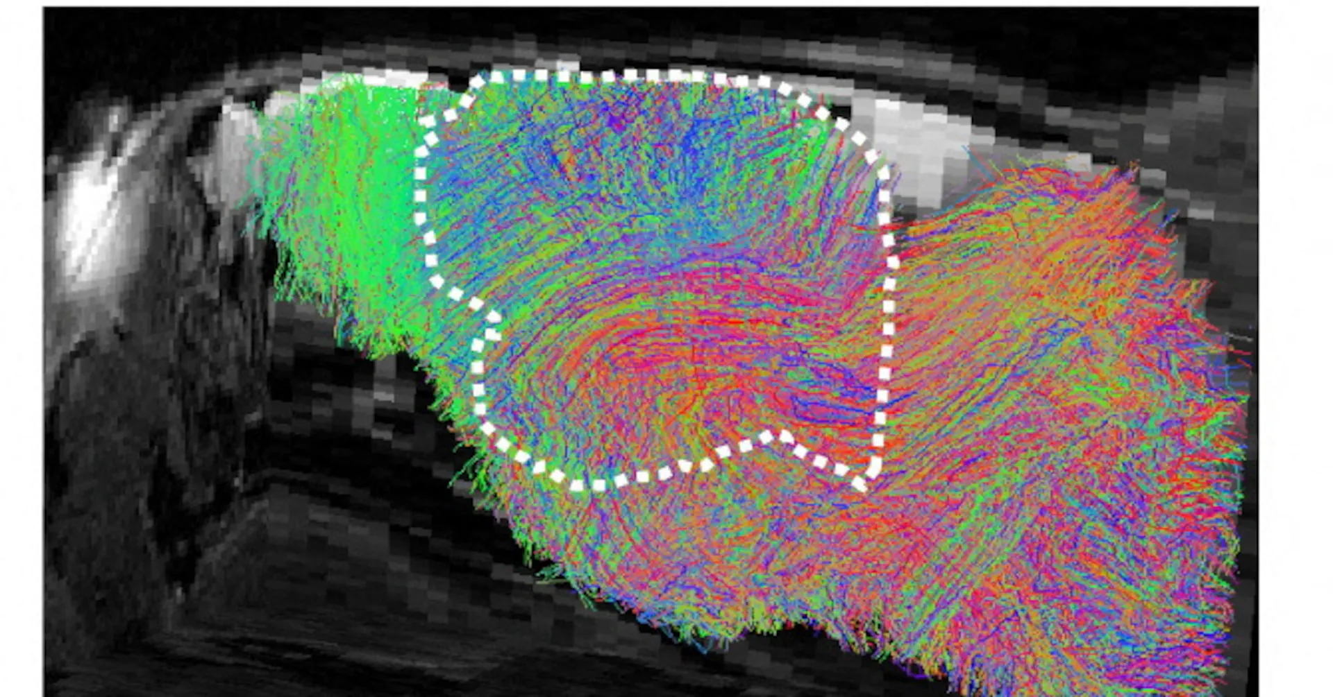 Lab-grown human brain tissue successfully transplanted into mice in neuroscience breakthrough