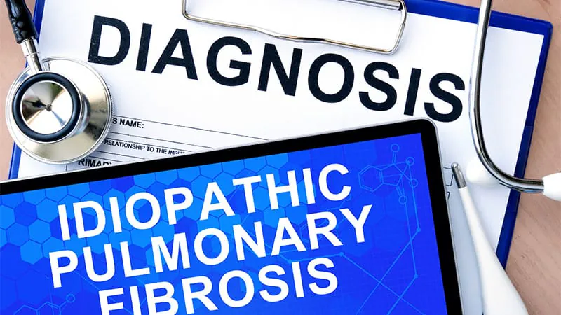 Hit harder or tread carefully? The pulmonary fibrosis treatment debate heats up