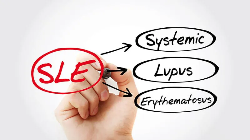 Lupus more than doubles stroke risk, major meta-analysis confirms