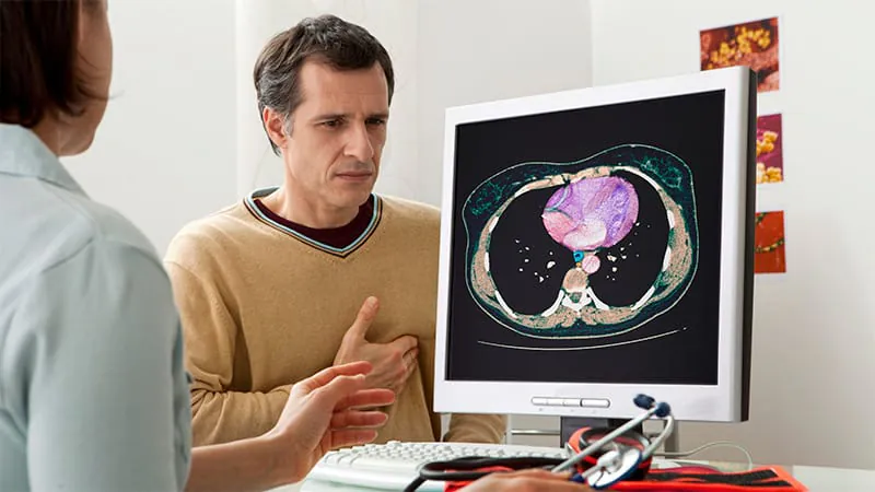 A simple CT ratio could help rule out coronary artery disease — no stress test needed