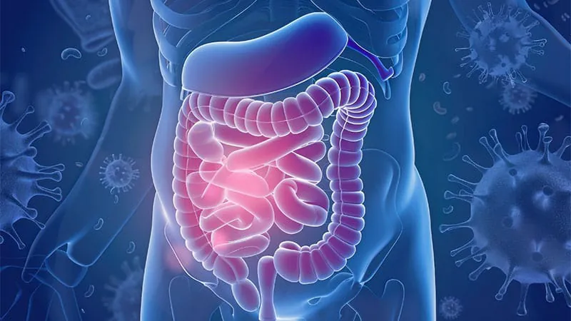 High-dose probiotic shows promise for chronic diarrhea linked to bile acid malabsorption