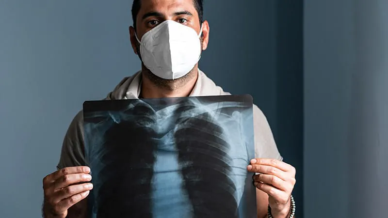 Asylum seekers face 3x higher TB detection rate than immigrants in Dutch screening program