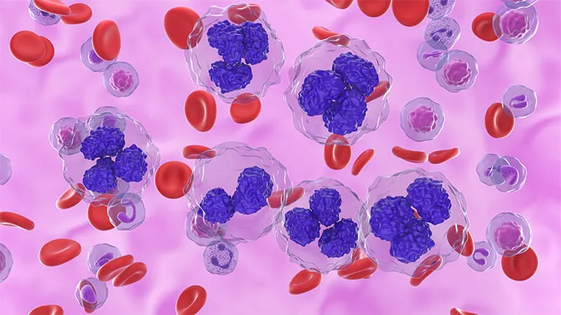 Rituximab + lenalidomide maintenance falls short in older follicular lymphoma patients — but age matters