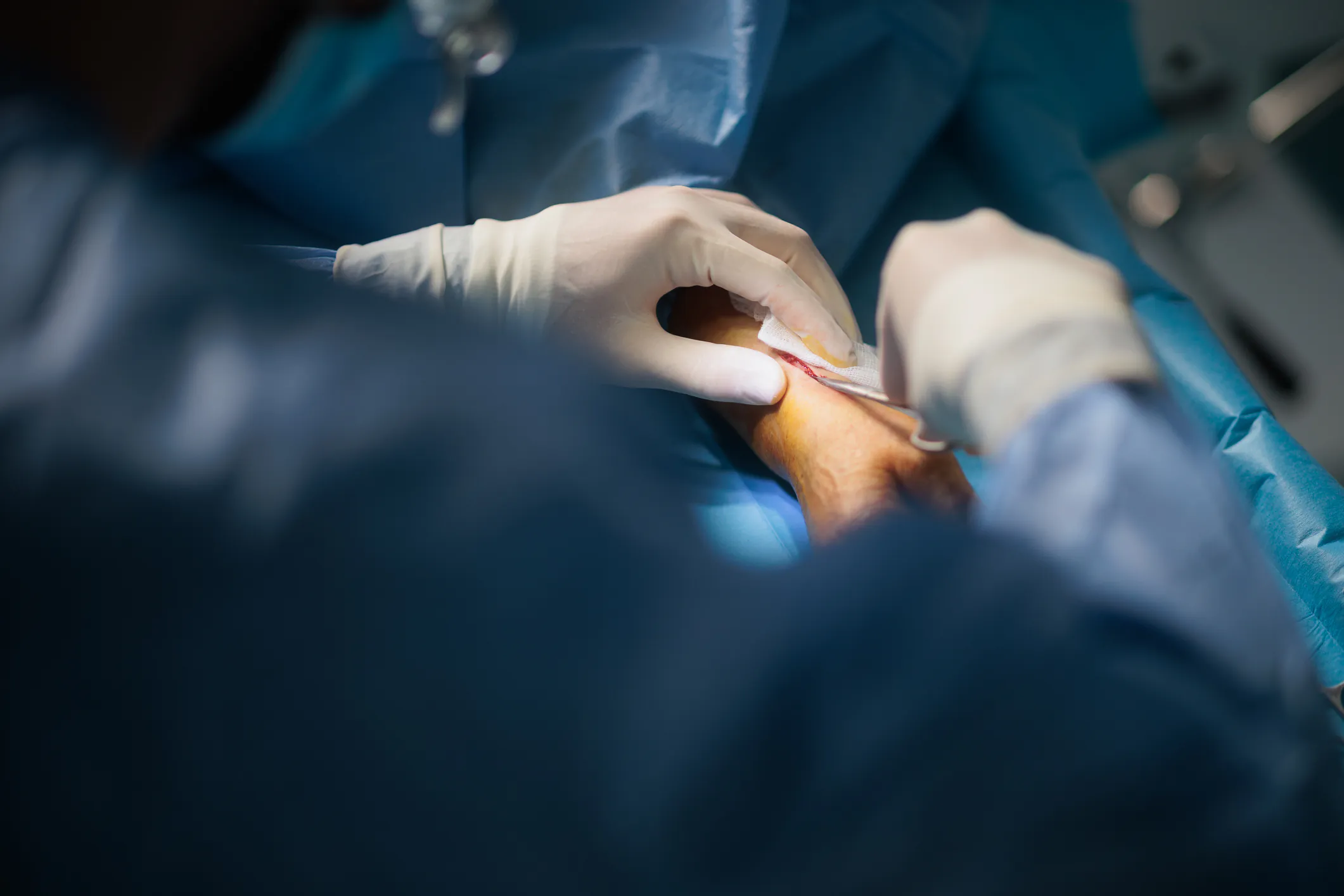 Short antibiotic courses work just as well — with fewer side effects — for orthopedic infections